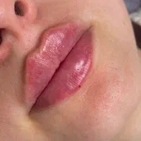 مدل تزریق ژل و بوتاکس و آموزش در کلینیک زیبایی|خدمات آرایشگری و زیبایی|کرج, چهارصد دستگاه|دیوار