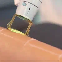 دستگاه لیزر مو