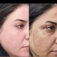 نمایندگی کرم رویال پنج تادهدرجه روشن کنندضدلک قوی|آرایشی، بهداشتی، درمانی|یاسوج, |دیوار