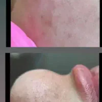 خدمات و اموزش فشیال (پاکسازی صورت)|خدمات آرایشگری و زیبایی|کرمانشاه, |دیوار