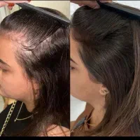 تارهای مو هنوز امید دارن