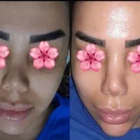 فشیال کلاسیک