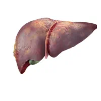 رفع کبد چرب تضمینی