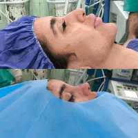 جشنواره عمل بینی با تخفیف آبان به رسم هرساله|خدمات آرایشگری و زیبایی|ساری, |دیوار