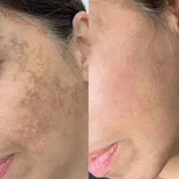 شما برندترین کلینیک زیبایی درایران را پیدا کردید|خدمات آرایشگری و زیبایی|کاشان, میدان کهنه|دیوار