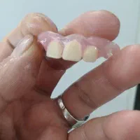 جشنواره مرکزدست دندان وساخت دندانهای مصنوعی ژلهای|خدمات آرایشگری و زیبایی|کرج, مطهری|دیوار