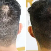 تار موهات روز به روز ضعیف ترمیشن