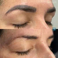 ریموو تخصصی تتوی ابرو و خط چشم و بدون آسیب