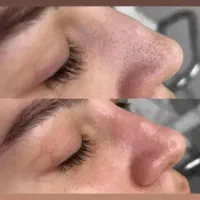 فیشیال تخصصی پوست