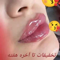 ژل وبوتاکس تخصصی در صدرا -گلستان