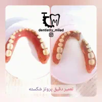 دندان سازی،مصنوعی،دندان متحرک،دندانسازی|خدمات آرایشگری و زیبایی|ارومیه, |دیوار