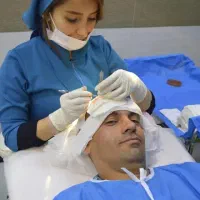 کاشت مو و ابرو ، بلفاروپلاستیک ، لیفت شقیقه و ابرو|خدمات آرایشگری و زیبایی|اهواز, نادری|دیوار