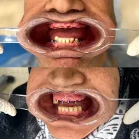 ایمپلنت-لمینت-کامپوزیت اقساط-گارانتی- دندانپزشکی|خدمات آرایشگری و زیبایی|مشهد, سجاد شهر|دیوار
