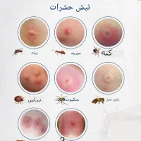 سم پاشی  انواع حشرات سمپاشی مطمئن واصولی