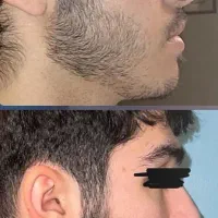 موهات مثل چمن میشه