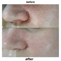 پاکسازی|خدمات آرایشگری و زیبایی|سنقر, |دیوار