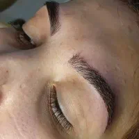 میکروبلیدینگ و میکروپیگمنتیشن