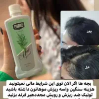 تونیک ضدریزش مو