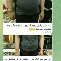 درمان چاقی با مشاوره رایگان|فعالیت داوطلبانه|ماهدشت, |دیوار