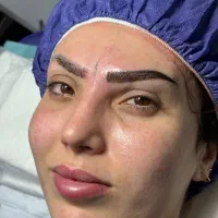میکروکاشت ابرو، نانو کاشت ابرو،مزوتراپی،کاشت مو|خدمات آرایشگری و زیبایی|تهران, شهرک ولیعصر شمالی|دیوار