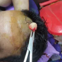 پانسمان وجراحی های سرپایی،ختنه،زگیل تناسلی|خدمات آرایشگری و زیبایی|اهواز, شریعتی جنوبی|دیوار
