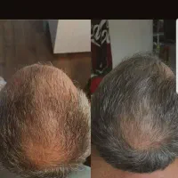 افزایش تراکم کل نواحی