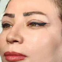 بلفاروپلاستی ،سانترال،دایرکت ابرو،کاشت vipجشنواره