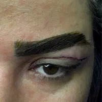 انواع جراحی های زیبایی صورت و بدن|خدمات آرایشگری و زیبایی|رشت, آتشگاه|دیوار