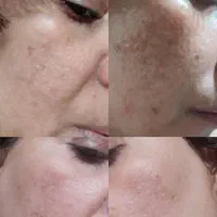 روغن های اصل برای پوست|آرایشی، بهداشتی، درمانی|اصفهان, ملاصدرا|دیوار