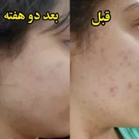 پوستتو با ما ترمیم کن|آرایشی، بهداشتی، درمانی|شیراز, ستارخان|دیوار
