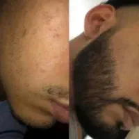 شاید بدون یار بشه اما بدون ریش اصلا نمیشه