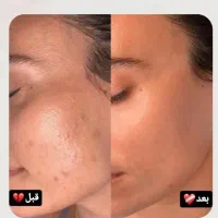 کرم ترمیم کننده گاتیو|آرایشی، بهداشتی، درمانی|شبستر, |دیوار