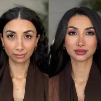 کلینیک زیبایی مایا جشنواره فیلر بوتاکس نخ prp مزو