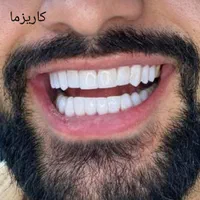 مرکز خدمات کامپوزیت دندان شیراز دندانپزشکی|خدمات آرایشگری و زیبایی|شیراز, قصرالدشت|دیوار
