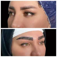 ۱۰ میلیون تخفیف کاشت ابرو