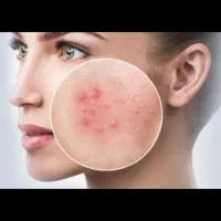 خدمات تخصصی پوست و مو