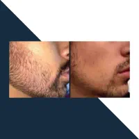 مثل موز رشدش بده