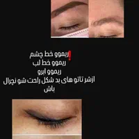 ریموو تک جلسه ای با رژووی پلاس خفن ابرو خطچشم|خدمات آرایشگری و زیبایی|کرمان, |دیوار