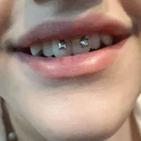 جراحی،لیفت،پرسینگ،گواهی عروس،زیبایی صورت و بدن|خدمات زیبایی و سلامت|کرمانشاه, |دیوار