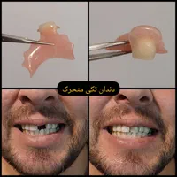 دندانسازی دندان مصنوعی|خدمات آرایشگری و زیبایی|شیراز, شهرک گلستان|دیوار