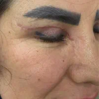 انواع جراحی های زیبایی صورت و بدن|خدمات آرایشگری و زیبایی|رشت, آتشگاه|دیوار