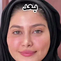 تزریق چربی ، تزریق ژل ، بوتاکس ، جراحی در مطب|خدمات آرایشگری و زیبایی|نورآباد, |دیوار