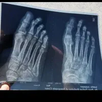 فیزیوتراپی واشعه درمانی کادراقاوخانم درمنزل