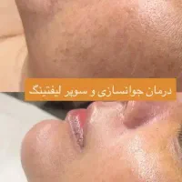 پوست زیبا و براق|خدمات آرایشگری و زیبایی|اردبیل, |دیوار