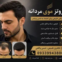 خدمات پروتز مو