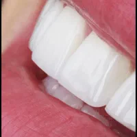کامپوزیت تخفیف ویژه به مناسبت پاییز|خدمات آرایشگری و زیبایی|کرج, گوهردشت|دیوار