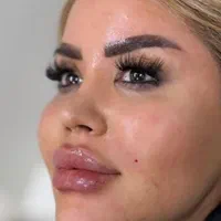 جشنواره تزریق ژل و بوتاکس/آموزش تخصصی/فشیال تخصصی|خدمات آرایشگری و زیبایی|اندیشه, اندیشه فاز ۱|دیوار