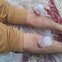 دمنوش کلیه حجامت بادکش|آرایشی، بهداشتی، درمانی|کازرون, |دیوار