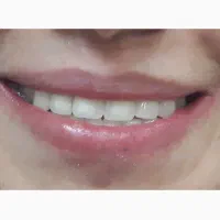 منشی و دستیار خانم جهت مطب دندانپزشکی|استخدام درمانی، زیبایی، بهداشتی|تهران, شهرآرا|دیوار
