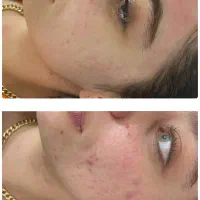 آموزش صفرتاصد پاکسازی وفیشال بامدرک(تخفیف جشنواره|خدمات آموزشی|شیراز, فرهنگ شهر|دیوار